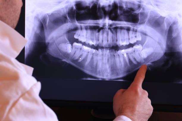 Best Emergency Cosmetic Dentistry in Upper Greenwood Lake, NJ