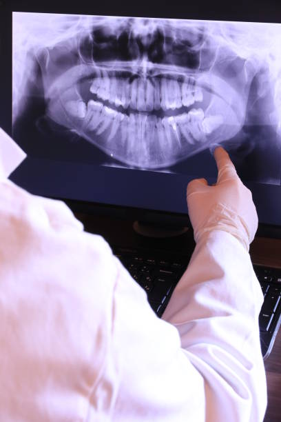 Best Emergency Dental Care for Abscessed Tooth in Upper Greenwood Lake, NJ