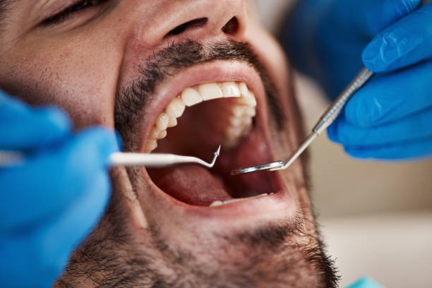 Best Emergency Dentist for Lost Fillings or Crowns in Upper Greenwood Lake, NJ